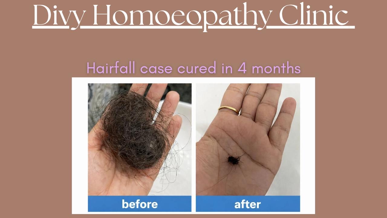 Hairfall before and after result